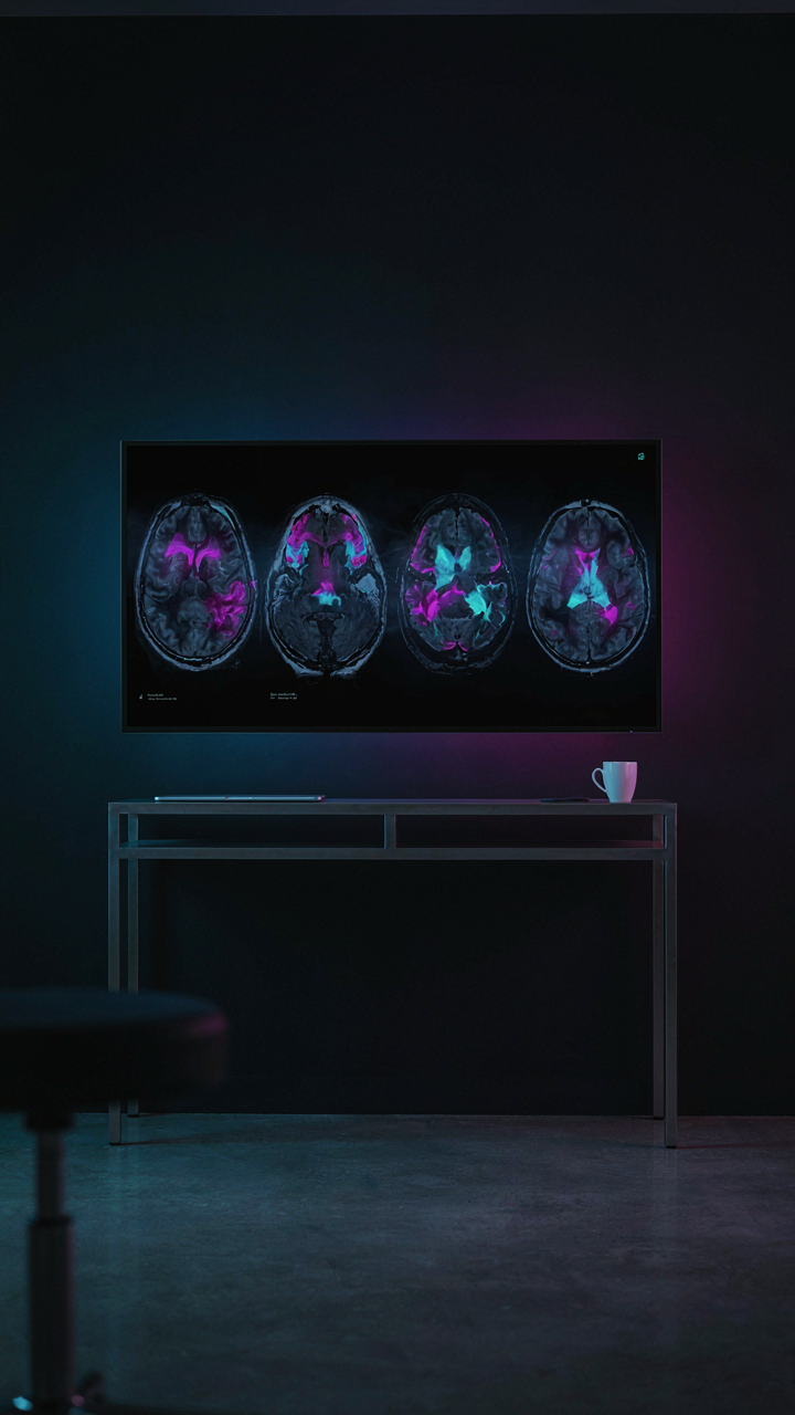 A brain scan image on a medical screen shows different parts of the brain lighting up.
